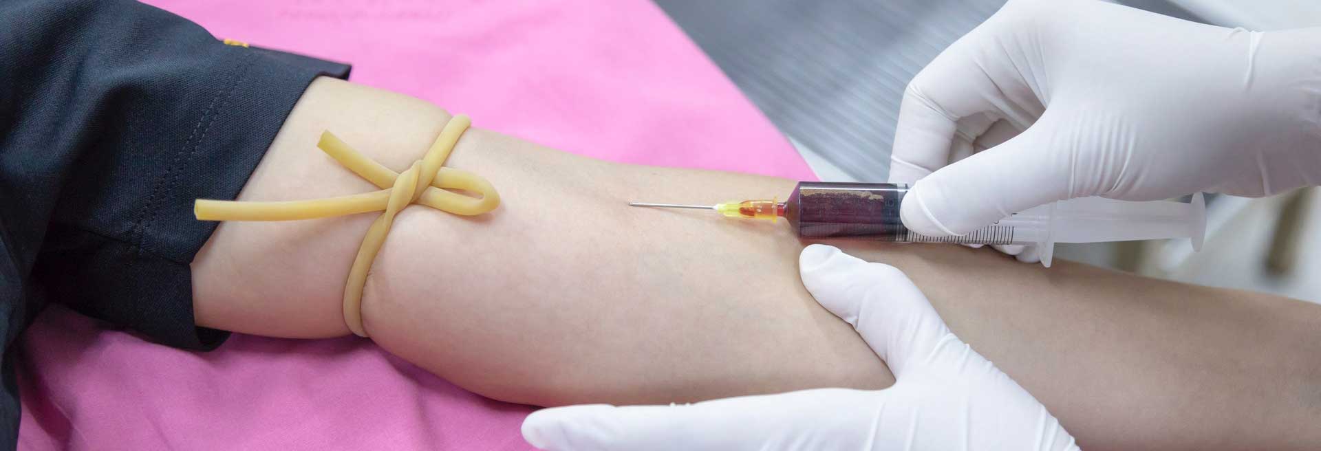 Medical blood collection procedure